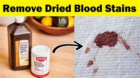 what dissolves dried blood